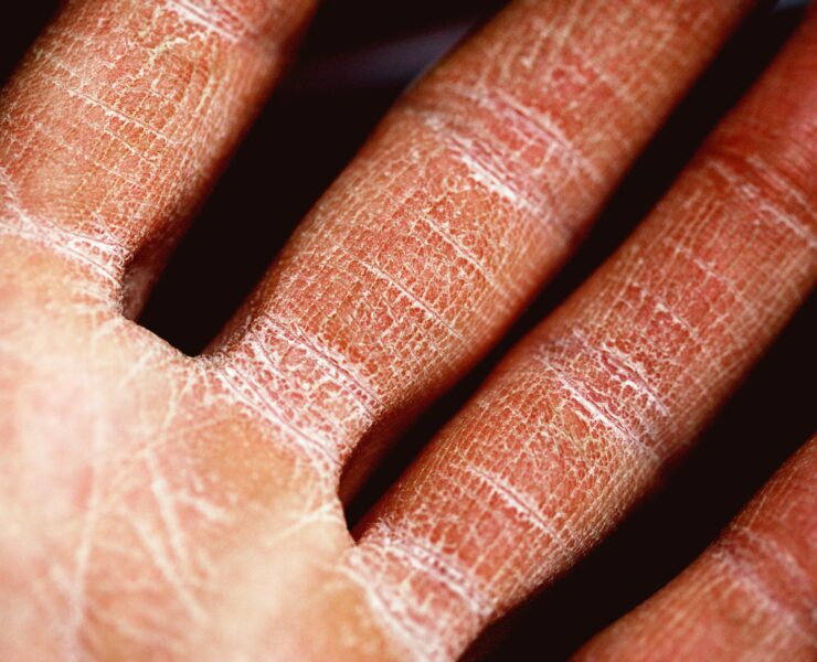 femmeguru combat dry skin this fall