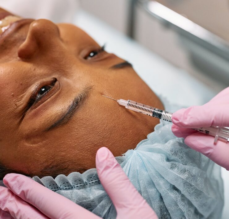 femmeguru jelly roll botox